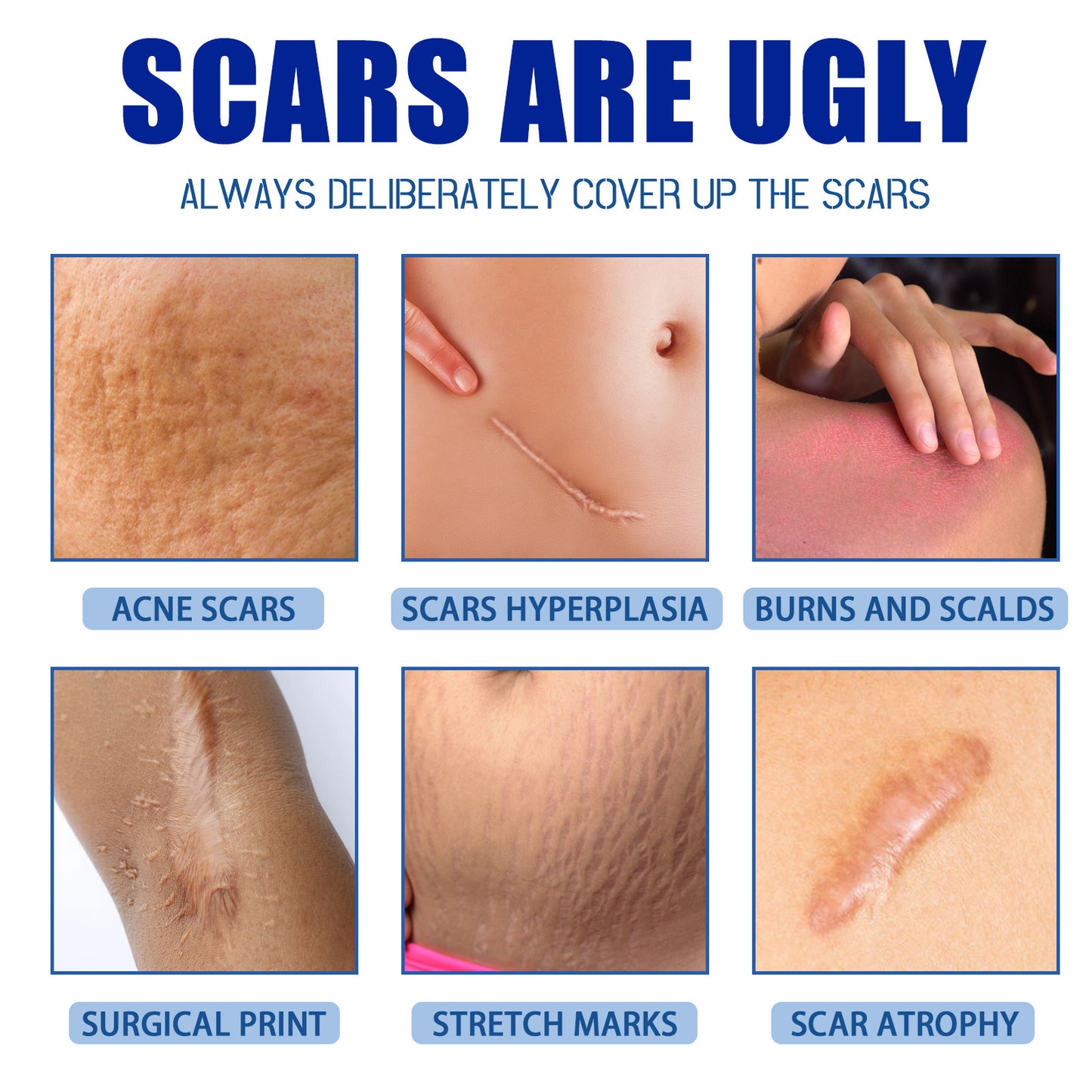 RenewScar