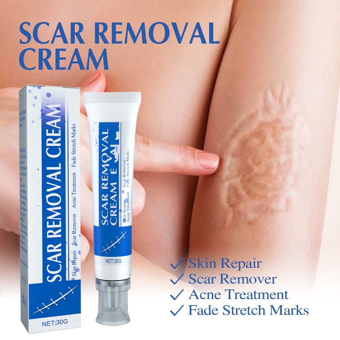 RenewScar