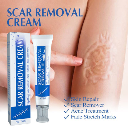 RenewScar